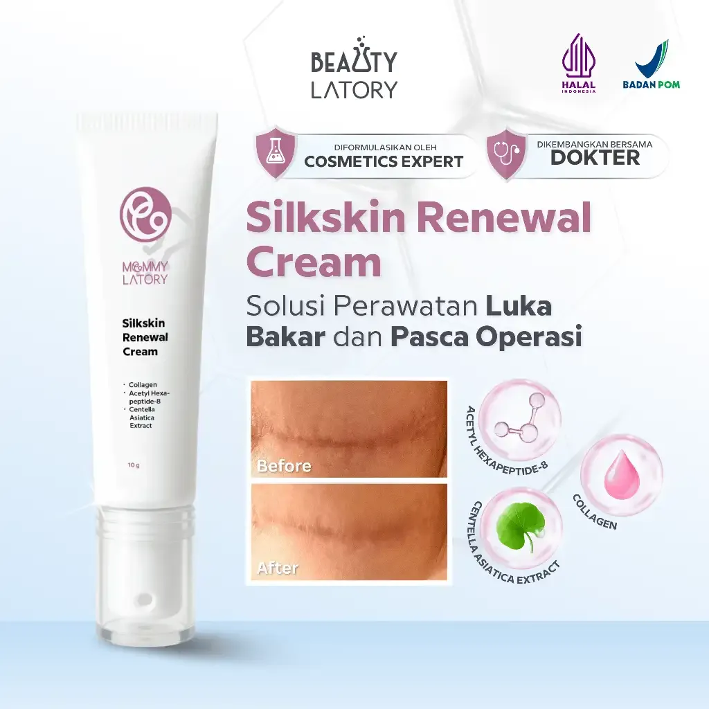 MOMMYLATORY Silk Skin Renewal Cream 10g - Krim Penghilang Bekas Luka